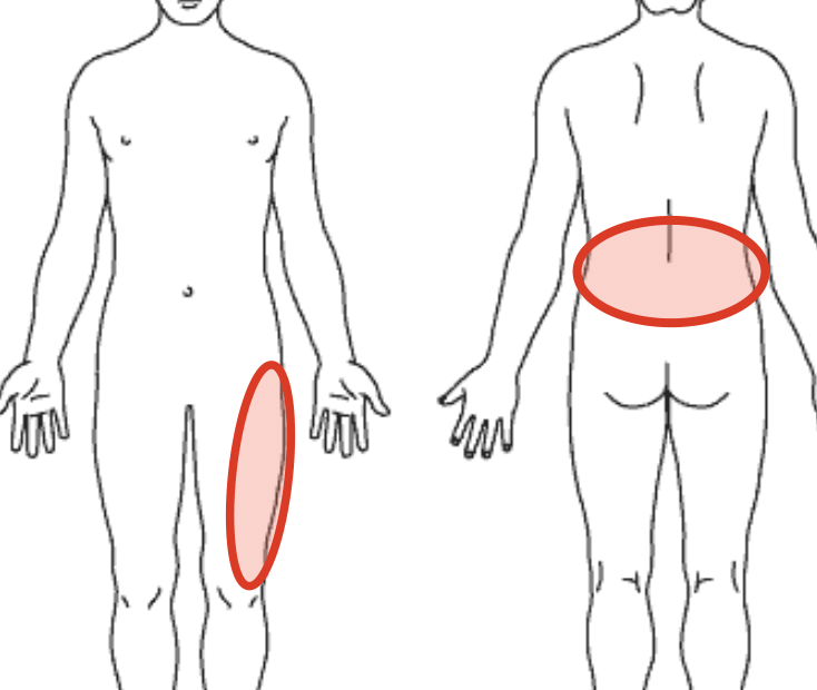 腰の痛みの場所を示す図