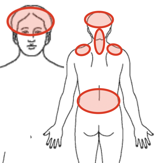 首の痛みの場所を示す図