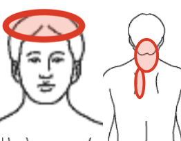 首の痛みの場所を示す図
