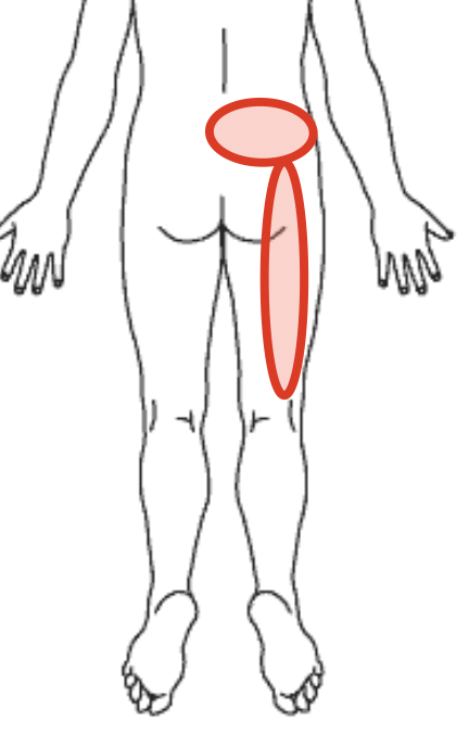 腰と股関節の痛みの場所を示す図